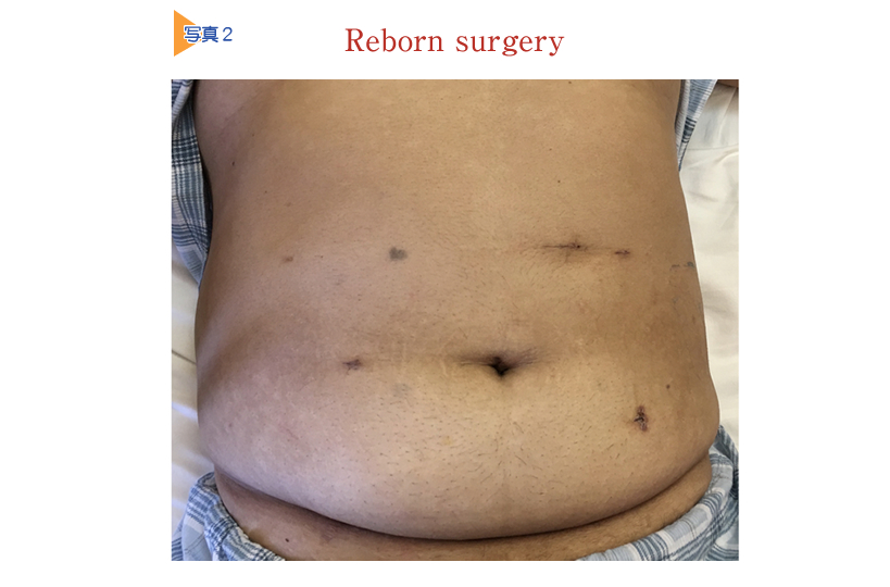 RebornSurgery